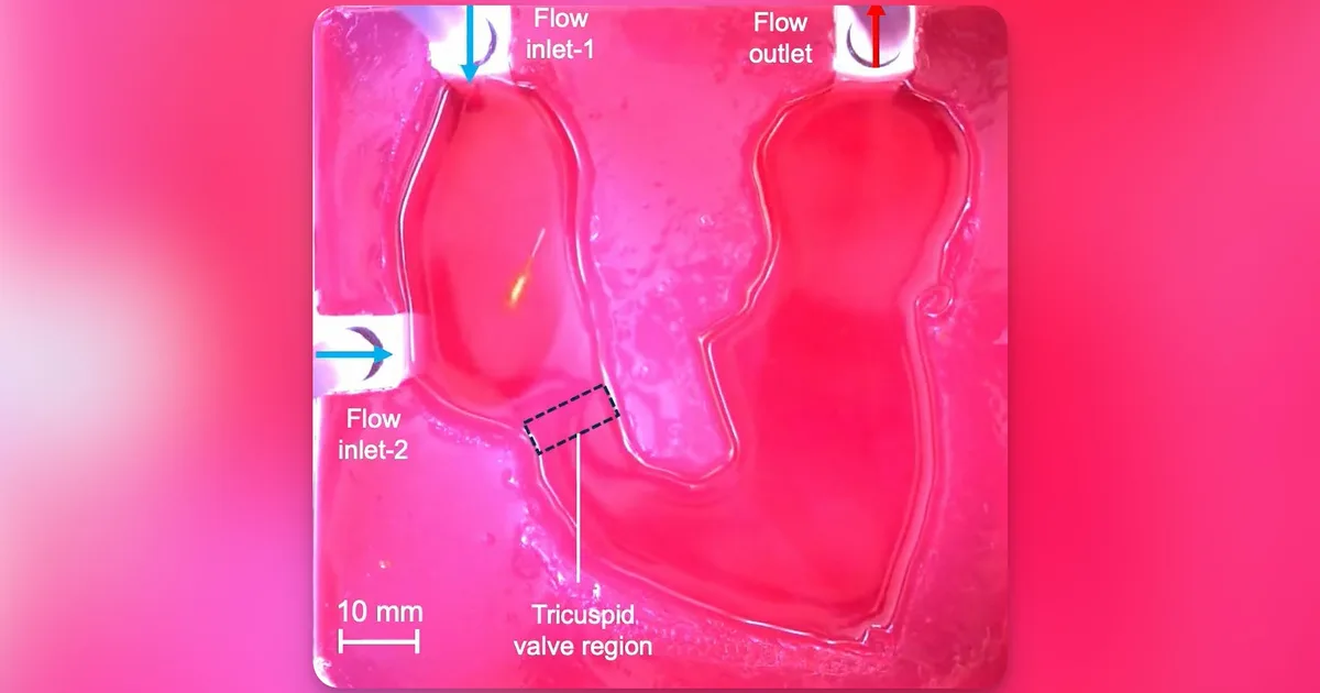 Tiny robots could shrink weeks of heart infection treatment into a single day