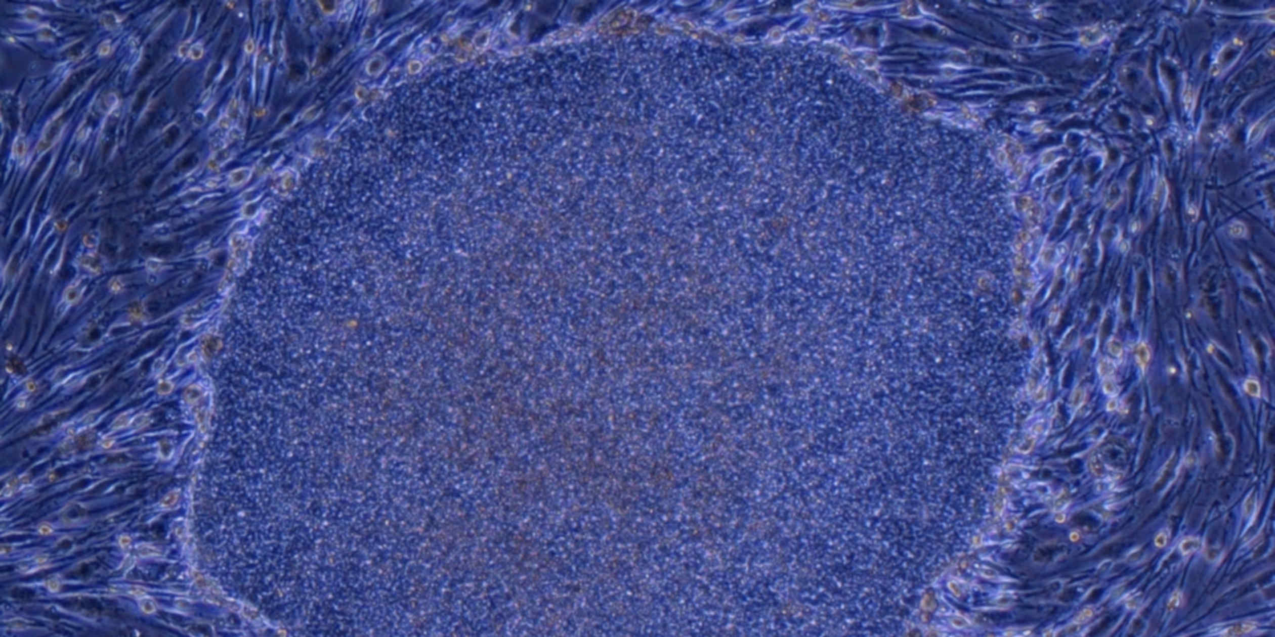 Japan aims to develop 'next-gen' iPS cells for strokes and kidney failure