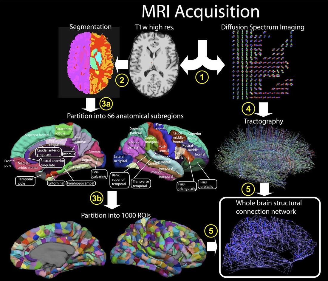 The Complete Connectome Explained: What a Finished Brain Map Tells Us About AI Agents (2026)