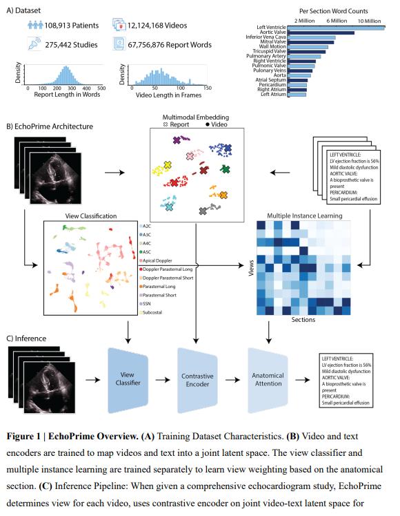 EchoPrime: Multi-Video View-Informed Vision-Language Model for Comprehensive Echocardiography Interpretation
